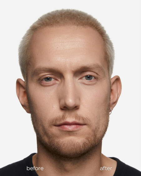 Anti-cernes liftant avec des peptides